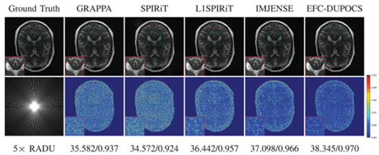 Enhanced feature contrastive self-supervised learning method based on deep unfolding POCS for accelerated parallel MRI reconstruction