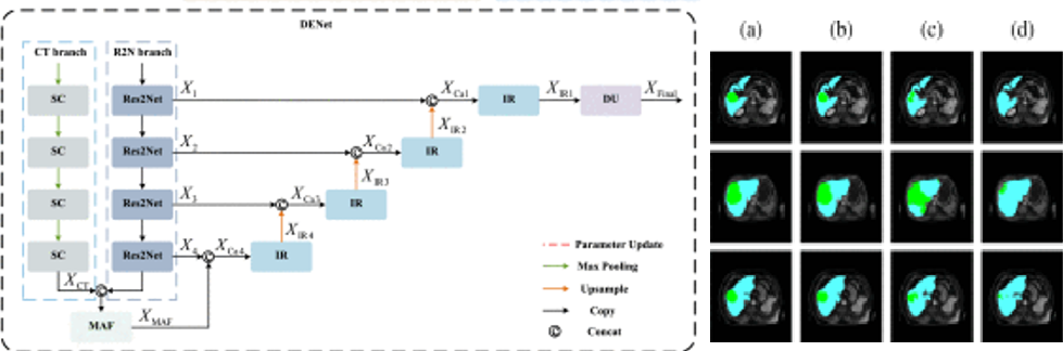 MAFDE-Net: Multipath attention-fusion-based dual-encoder network for undersampled MRI segmentation