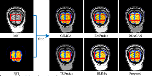 SAFFusion: A saliency-aware frequency fusion network for multimodal medical image fusion